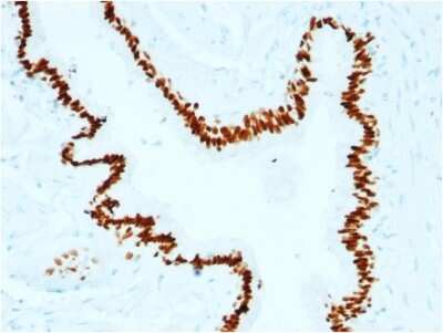 Immunohistochemistry-Paraffin: SOX2 Antibody (SOX2/1791) [NBP2-53407]