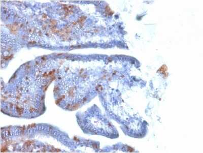Immunohistochemistry-Paraffin: SOX2 Antibody (SOX2/1791) [NBP2-53407]