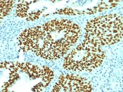 Immunohistochemistry-Paraffin: SOX2 Antibody (SOX2/1792) - Azide and BSA Free [NBP2-54593]