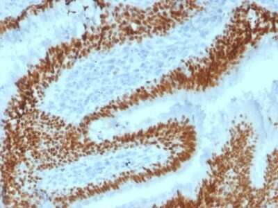 Immunohistochemistry-Paraffin: SOX2 Antibody (SOX2/1792) - Azide and BSA Free [NBP2-54593]