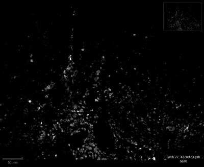 Immunohistochemistry-Paraffin: SOX2 Antibody (SOX2/1792) - Azide and BSA Free [NBP2-54593]