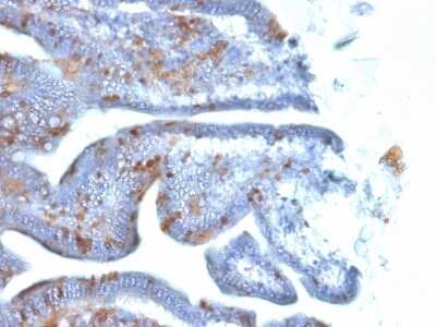 Immunohistochemistry-Paraffin: SOX2 Antibody (SOX2/1792) [NBP2-53408]