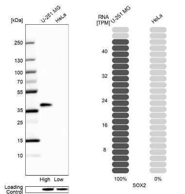 Western Blot: SOX2 Antibody [NBP2-58318]