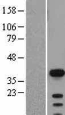 Western Blot: SOX2 Overexpression Lysate [NBL1-16348]
