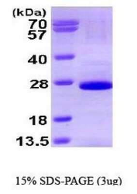 SDS-PAGE: Recombinant Human SOX2 His Protein [NBP1-41144]