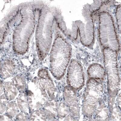 Immunohistochemistry-Paraffin: SOX21 Antibody (CL4681) [NBP2-59058]