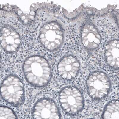 Immunohistochemistry-Paraffin: SOX21 Antibody (CL4681) [NBP2-59058]