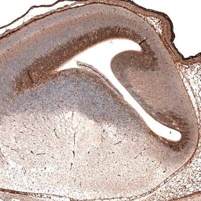 Immunohistochemistry-Paraffin: SOX21 Antibody (CL4688) [NBP2-59059]