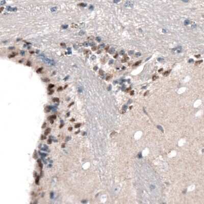 Immunohistochemistry-Paraffin: SOX21 Antibody (CL4688) [NBP2-59059]