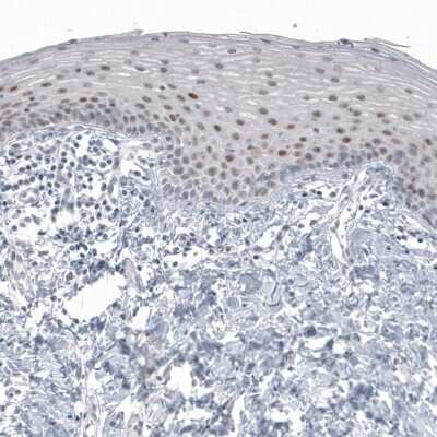 Immunohistochemistry-Paraffin: SOX21 Antibody (CL4688) [NBP2-59059]