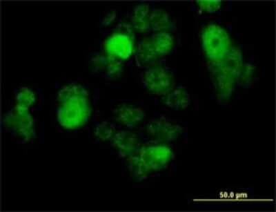 Immunocytochemistry/ Immunofluorescence: SOX30 Antibody (6H1) [H00011063-M02]
