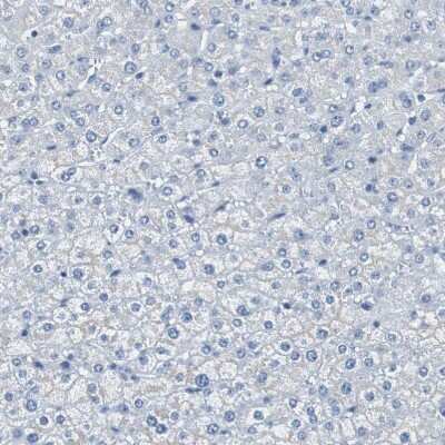 Immunohistochemistry-Paraffin: SOX30 Antibody [NBP1-86503]