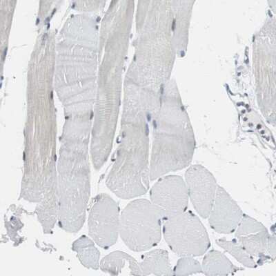 Immunohistochemistry-Paraffin: SOX30 Antibody [NBP1-86503]