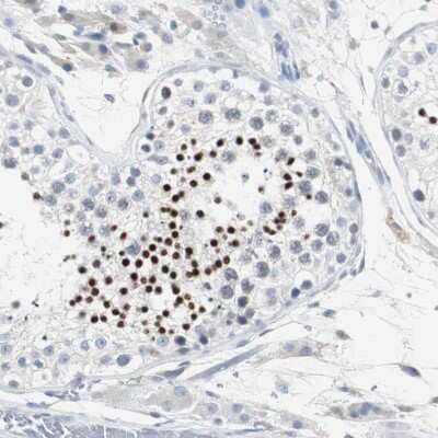Immunohistochemistry-Paraffin: SOX30 Antibody [NBP1-86503]