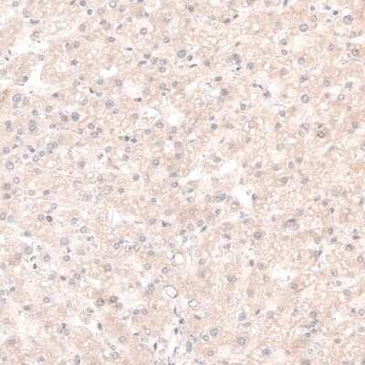 Immunohistochemistry-Paraffin: SOX4 Antibody (CL5665) [NBP2-61421]