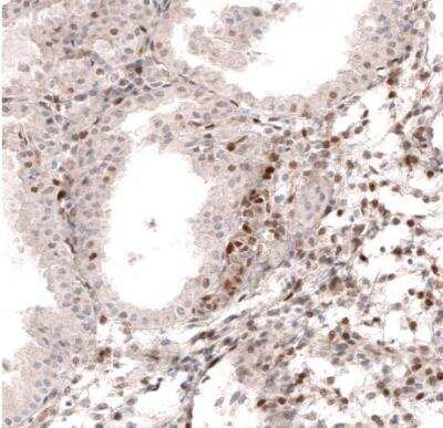 Immunohistochemistry-Paraffin: SOX4 Antibody (CL5665) [NBP2-61421]