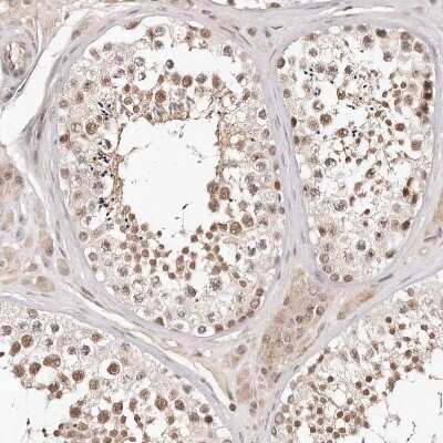 Immunohistochemistry-Paraffin: SOX4 Antibody [NBP1-89506]