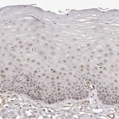Immunohistochemistry-Paraffin: SOX4 Antibody [NBP1-89506]