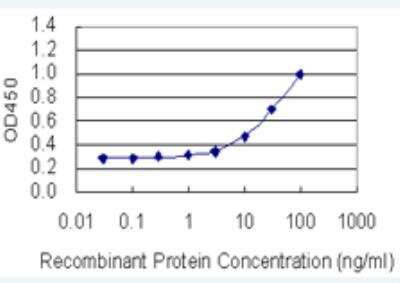 ELISA: SOX5 Antibody (4H8) [H00006660-M01-100ug]