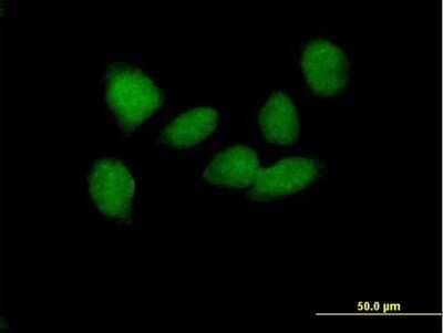 Immunocytochemistry/ Immunofluorescence: SOX6 Antibody [H00055553-B01P]