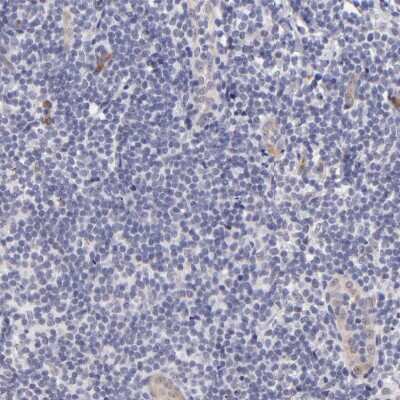 Immunohistochemistry-Paraffin: SOX6 Antibody [NBP1-85811]
