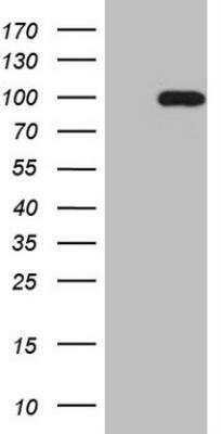 Western Blot: SOX6 Antibody (OTI1E7) [NBP2-45917]