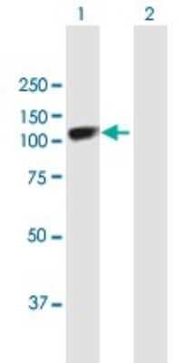 Western Blot: SOX6 Antibody [H00055553-B01P]