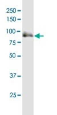 Western Blot: SOX6 Antibody [H00055553-B01P]