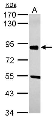 Western Blot: SOX6 Antibody [NBP2-20458]