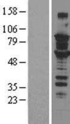 Western Blot: SOX6 Overexpression Lysate [NBL1-16354]