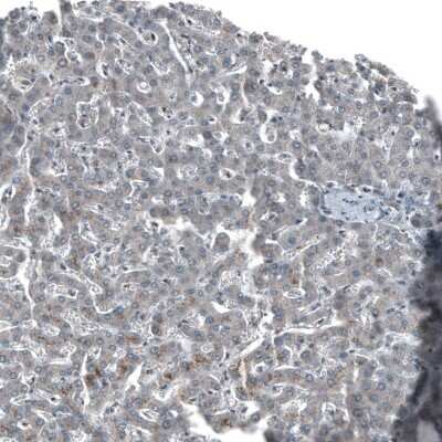 Immunohistochemistry-Paraffin: SOX7 Antibody [NBP1-86116]
