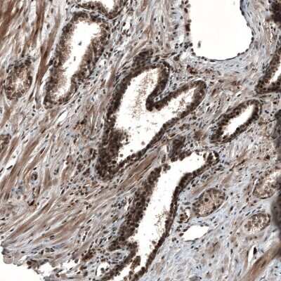 Immunohistochemistry-Paraffin: SOX7 Antibody [NBP1-86116]