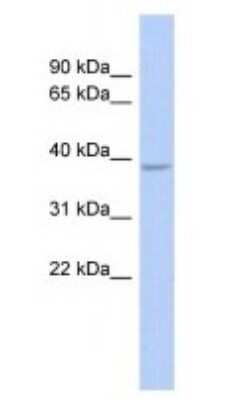 Western Blot: SOX7 Antibody [NBP1-80374]