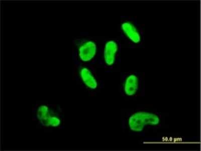 Immunocytochemistry/ Immunofluorescence: SOX9 Antibody (3C10) [H00006662-M02]