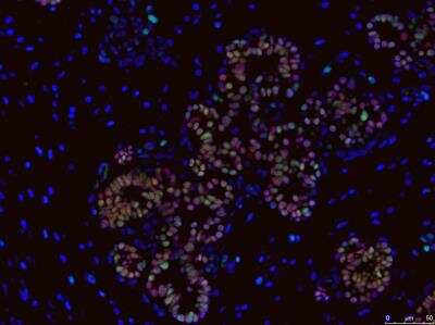 Immunohistochemistry-Paraffin: SOX9 Antibody (3C10) [H00006662-M02]