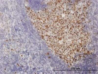 Immunohistochemistry-Paraffin: SOX9 Antibody (3C10) [H00006662-M02]