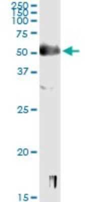 Immunoprecipitation: SOX9 Antibody (3C10) [H00006662-M02]