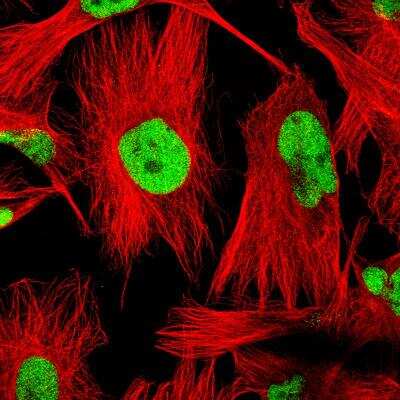 Immunocytochemistry/ Immunofluorescence: SOX9 Antibody (CL0639) [NBP2-52943]