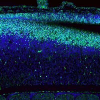 Immunohistochemistry: SOX9 Antibody (CL0639) [NBP2-52943]