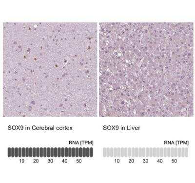 Immunohistochemistry-Paraffin: SOX9 Antibody (CL0639) [NBP2-52943]