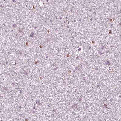 Immunohistochemistry-Paraffin: SOX9 Antibody (CL0639) [NBP2-52943]