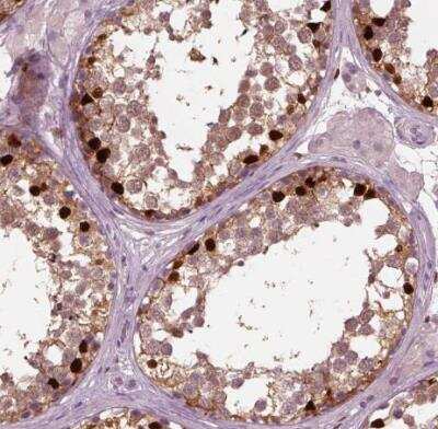 Immunohistochemistry-Paraffin: SOX9 Antibody (CL0639) [NBP2-52943]