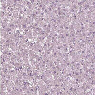 Immunohistochemistry-Paraffin: SOX9 Antibody (CL0639) [NBP2-52943]