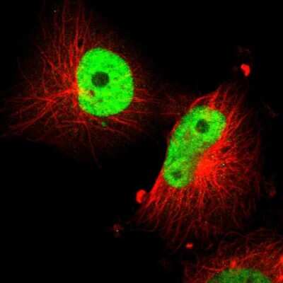 Immunocytochemistry/ Immunofluorescence: SOX9 Antibody [NBP1-85551]