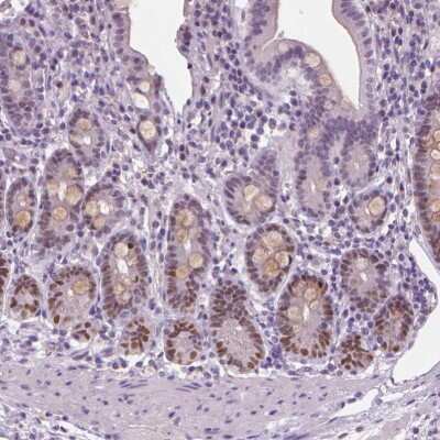Immunohistochemistry-Paraffin: SOX9 Antibody [NBP1-85551]