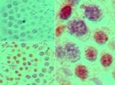 Immunohistochemistry-Paraffin: SOX9 Antibody [NBP2-24659]