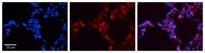 Immunohistochemistry: SP-B/Surfactant Protein B Antibody [NBP1-57977]