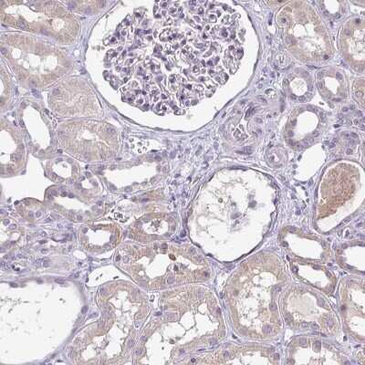 Immunohistochemistry-Paraffin: SP-B/Surfactant Protein B Antibody [NBP2-33982]