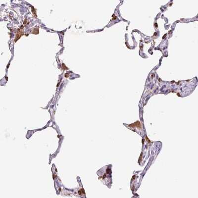 Immunohistochemistry-Paraffin: SP-B/Surfactant Protein B Antibody [NBP2-33982]