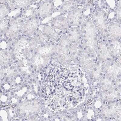Immunohistochemistry-Paraffin: SP-B/Surfactant Protein B Antibody [NBP2-49359]